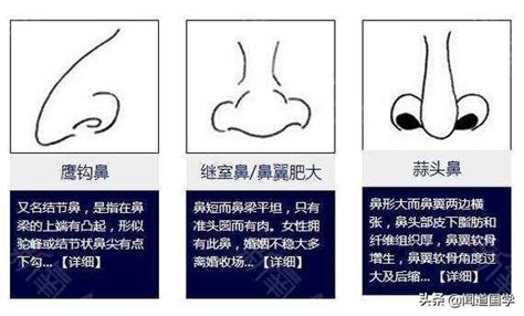 鼻 相學|面相解析何為蒜頭鼻